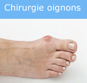 chirurgie-oignons